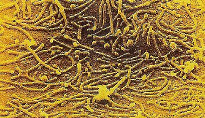 Bakterie s buněčnou stěnou grampozitivního typu Firmicutes Mollicutes Mycoplasmatales Mycoplasmataceae Mycoplasma M. pneumoniae Kolonie M.
