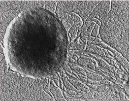 Archaea Euryarcheota Methanococci Methanococcales Methanococcaceae Methanococcus Buňky jsou ve tvaru