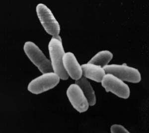 Archaea Euryarchaeota Halobacteria Halobacteriales Halobacteriaceae Halobacterium Růst ve slaném jezeře