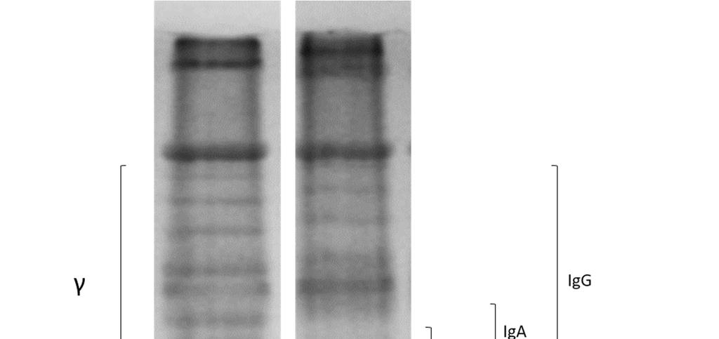 Při nativní elektroforéze sérových bílkovin nejrychleji putuje albumin. Pomaleji migrují globuliny, které lze podle pohyblivosti uspořádat do několika skupin označovaných řeckými písmeny α, β a γ.