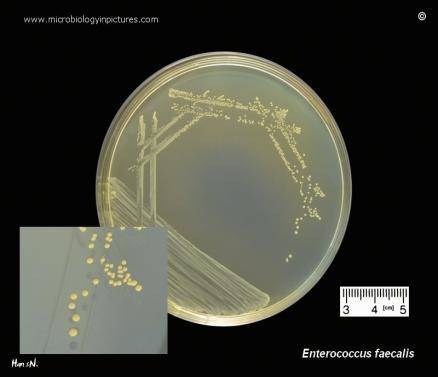 haemolytica Klebsiella pneumoniae Clostridium