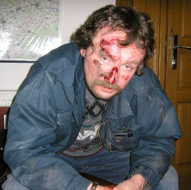 Při zjištění konzumace alkoholu mladistvými, mnohdy i nezletilými, řešila městská policie konkrétní případy s rodiči, třídními učiteli a řediteli škol.
