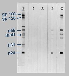 3.5.3. WESTERN BLOT Western blot (WB) je technika na bázi elektroforézy, imunochemie a enzymatické reakce.