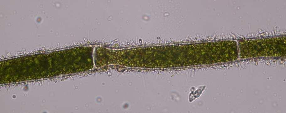 Třída Ulvophyceae (kadeřnatky) cvičení 3, vzorek 2 rybniční