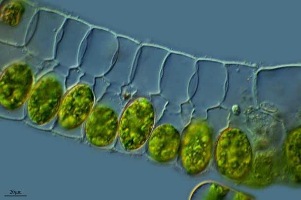 Třída Zygnematophyceae (spájivky) geneticky pokročilejší celá řada morfologických znaků vývojem ztracena jednobuněčné nebo vláknité nevětvené stélky s celistvou buněčnou stěnou pohlavní rozmnožování