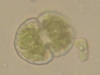 Třída Zygnematophyceae