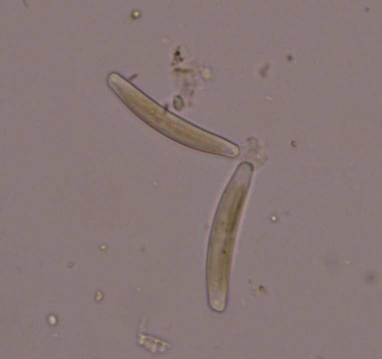 Třída Bacillariophyceae