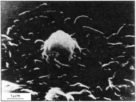 Obrázek 6 Stavba těla bakterie Acidithiobacillus ferrooxidans[4 ] Obrázek 7 Acidithiobacillus ferrooxidans na snímku z
