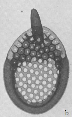 (a) Synura favus, (b) Synura curtispina f. curtispina, převzato z Kristiansen a Lind 1995, (c) Synura curtispina f.