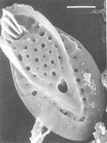 Mallomonas crassisquama, Mallomonas pseudocoronata, Mallomonas duerrschmidtiae M. crassisquama, M. pseudocoronata a M. duerrschmidtiae je komplex dalších velmi podobných Mallomonas.