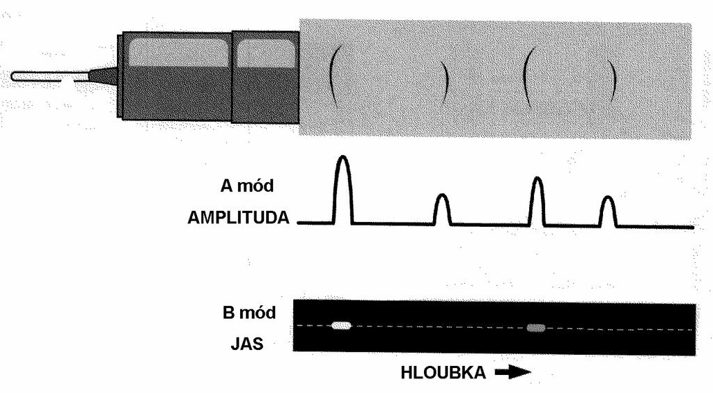 Převod amplitudy na jas B-způsob -