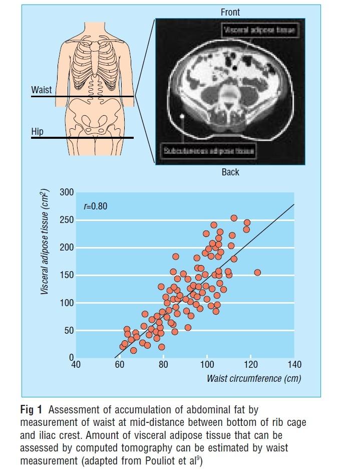 Diagnostická kritéria obvod břicha Després J P, Lemieux I, Prud'homme D: Treatment of