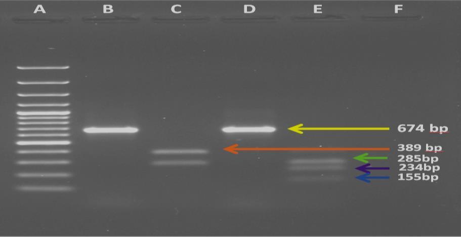 A 100 bp plus ladder; B, C- nízkoobsahové konopí amplifikační produkt PCR, C po restrikci AccI; D, E - vysokoobsahové konopí amplifikační produkt PCR, E po restrikci AccI, F negativní kontrola