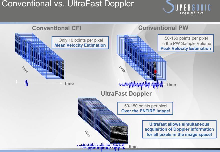 UltraFast