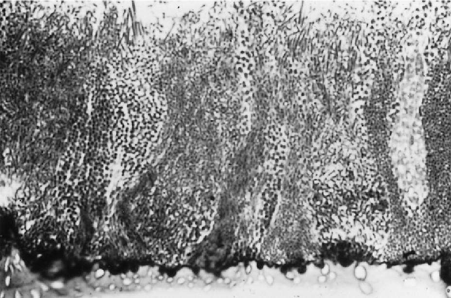 Orální biofilm houbovitá struktura s kanálky časní kolonizátoři: S. sanguinis, S. mutans, S.