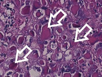 Objasnění neinfekčních onemocnění Mnoho lézí peří a kůže jako např. poškození per, stresové linie, abraze, pododermatitida, abscesy, atd.