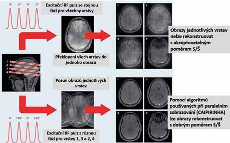 Obr. 21 Obr. 21. Princip simultánní excitace více vrstev (SMS).