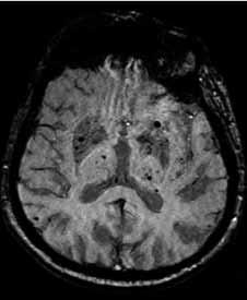 Měření série obrazů pro exponenciální fit je časově náročná, což je jedním z důvodů relativně řídkého klinického využití (převzato z (22)). Fig. 24.