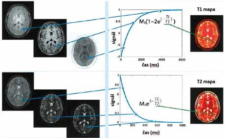 Measurement of the series of images for exponential fit is time consuming what is one of reasons of relatively rare clinical use (adopted from (22)). na obrázku 25 vlevo nahoře.
