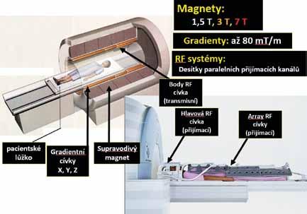 First MR Picker scanner is shown in upper right and MR images from these first scanners is shown in right bottom part.