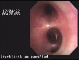 Kašel jako hlavní symptom Bronchiální