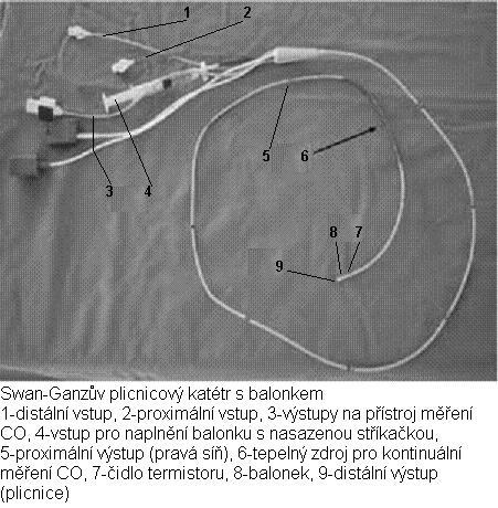 Monitorování serdečního výdeje 1. Klasickou metodou je plicní katetr Swan Ganz.