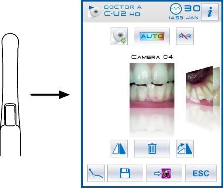 5.8. INTRAORÁLNÍ KAMERA C-U2 C-U2 je intraorální kamera speciálně navržená pro snadné použití při intraorálním zubním vyšetření, s velmi lehkým násadcem, automatickou kontrolou expozice a pevným