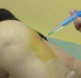 o d b o r n ý č l á n e k Bursitis trochanterica -Tractitis illiotibialis Pacient udává bolesti kyčle vystřelující po zevní straně až ke kolenu.v noci na postižené straně nemůže pro bolesti ležet.