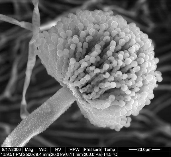 Aspergillus flavus mikroznaky, CCF 3056 5 um