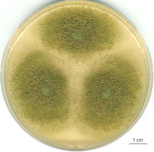 Aspergillus