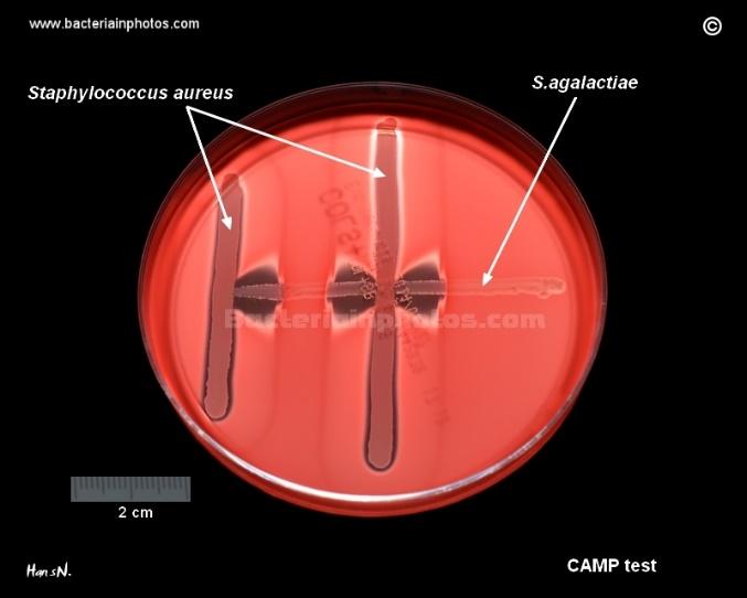 aurea s linií Streptococcus agalactiae, který vytváří CAMP faktor, dojde k hemolýze erytrocytů ovlivněných C sfingomyelinázou (beta-lysin) S.