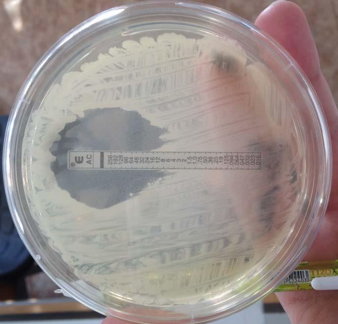 PRAKTICKÁ ZKOUŠKA 100. CN10 průměr 15 mm bakterie je na antibiotikum citlivá.