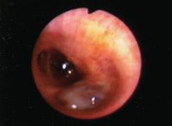 ZAJÍMAVÉ BRONCHOLOGICKÉ (A MORFOLOGICKÉ) NÁLEZY Obr. 22/3 14: Bronchoskopické vyšetření 24. 6. 2010 Obr. 22/3 Obr. 22/4 Obr. 22/5 Obr. 22/6 4 foto z archivu autorů Obr. 22/7 Obr. 22/8 Obr. 22/9 Obr.