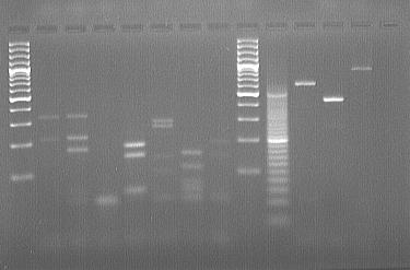 protože mají délku ampifikované DNA po PCR 500 bp, ale jinak nebyla nalezena shoda po restrikční analýze u těchto vzorků a jedinou typovou kvasinkou C. krusei. Tabulka č.