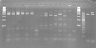 33: Elektroforeogram po štěpení vzorků vinných kvasinek endonukleázou AluI (délkový standard - 100 + bp, 1-16 - DNA vinných kvasinek po restrikční analýze, délkový standard - 20 bp, 2, 9,19 pozitivní