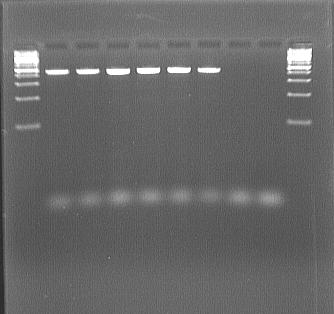 100 + M1 M2 M3 M4 M5 M6 M7 NK 100 + 100 + M1 M2 M3 M4 M5 M6 M7 NK 100 + Obrázek č. 41: Elektroforeogram amplifikované DNA Pichia fermentans.