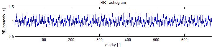 Zde (obrázek 30) jsou modely nastaveny na délku 700 vzorků. Opět je patrné, že tachogram generovaný IPFM modelem je pravidelný.