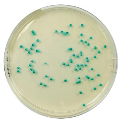 V laboratoři se používá komerční test Auxacolor 2 (BioRad) zahrnující 16 testů v mikrotitrační destičce.