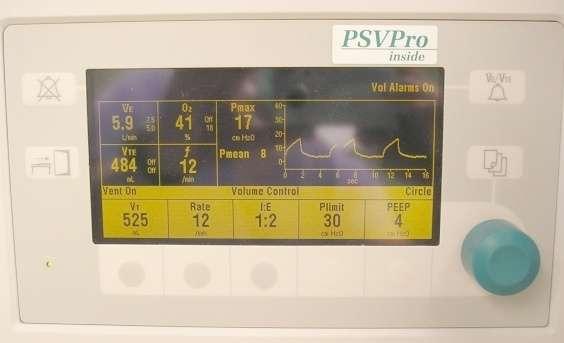 Optimální ventilace neexistuje tlakově řízená I:E poměr (1:2) malé