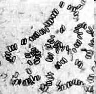 Paenibacillus larvae - původce
