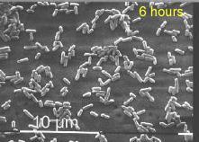 Tvorba biofilmu I Tvorba biofilmu II Tvorba biofilmu LM na čipu z nerezové oceli při 20 C, snímky z elektronového mikroskopu 67 (Chavant P., Hébraud M., Martinie B.