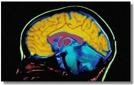 Zmenšení objemu mozku - manitol - drenáž