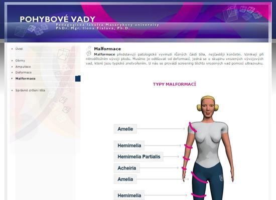 věnuje tématu pohybových vad Učebnice je doplněna o názorná schémata a několik animací Učebnice je studentům přístupná ve studijních materiálech