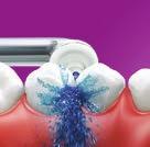 Celkové množství bakterií Bakterie červeného komplexu Bakterie oranžového komplexu AF-Or = původní AirFloss; AF-Ul = AirFloss Ultra; W = voda; L = Listerine; B = BreathRx (CPC, Zinek).
