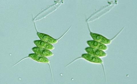 Cyanobacteria) rodů Nostoc, Anabaena, Aphanizomenon, Microcystis,