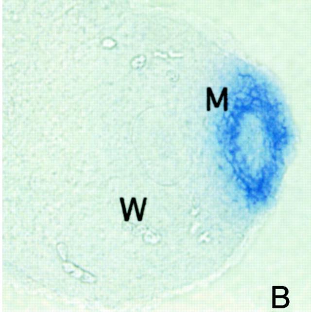 gestační týden - exprese receptoru MIS1 a MIS2, po navázání AMH regrese Můllerova vývodu
