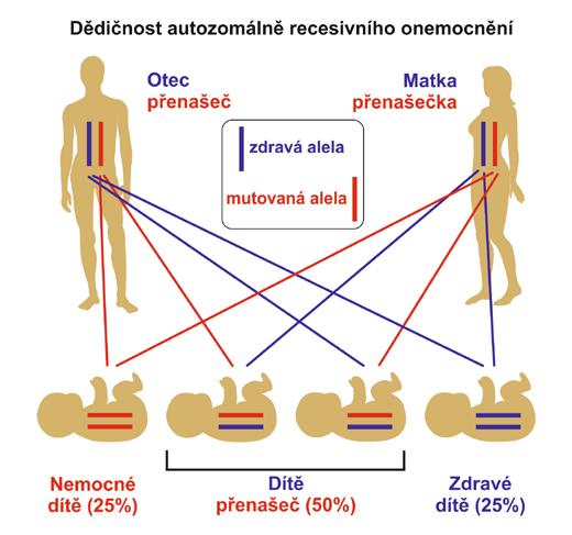 Po Duchenově svalové dystrofii je SMA druhé nejčastější neuromuskulární onemocnění (prevalence 1/8000) a je druhou nejčastější příčinou úmrtnosti kojenců na autozomálně recesivní chorobu.