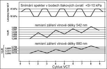 Obr. 2.2: Změna v prokrvení léčené a neléčené končetiny během typické aplikace VCT.