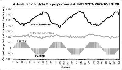 (např. bércových vředů nebo diabetických ulcerací, ale i v kosmetice, anti-aging apod.).