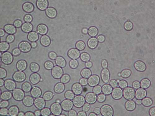 sepsí morfologie: elipsoidní i kulovité blastokonidie, některé kmeny tvoří cylindrické až protáhlé buňky, vytváří rudimentární nebo stromečkovité- bohatě